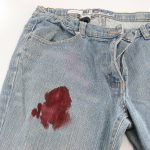 Фото 35: Кровь на джинсах